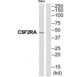 Western blot - CSF2RA Antibody from Signalway Antibody (35318) - Antibodies.com