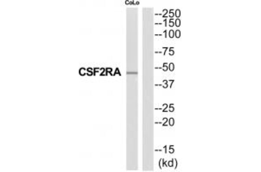 Western blot - CSF2RA Antibody from Signalway Antibody (35318) - Antibodies.com