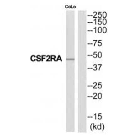 Western blot - CSF2RA Antibody from Signalway Antibody (35318) - Antibodies.com