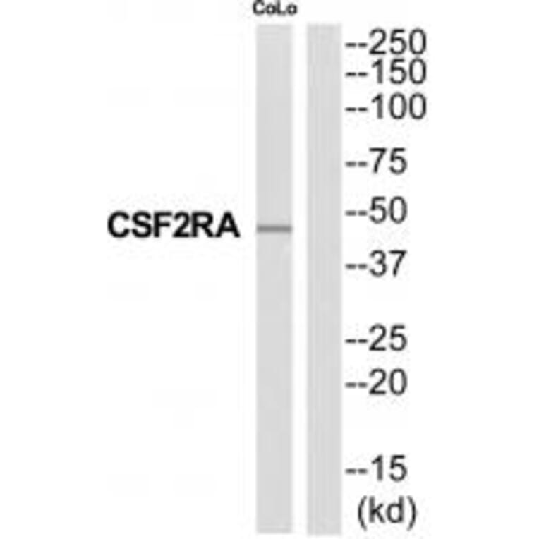 Western blot - CSF2RA Antibody from Signalway Antibody (35318) - Antibodies.com