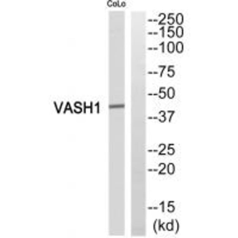 Western blot - VASH1 Antibody from Signalway Antibody (35319) - Antibodies.com