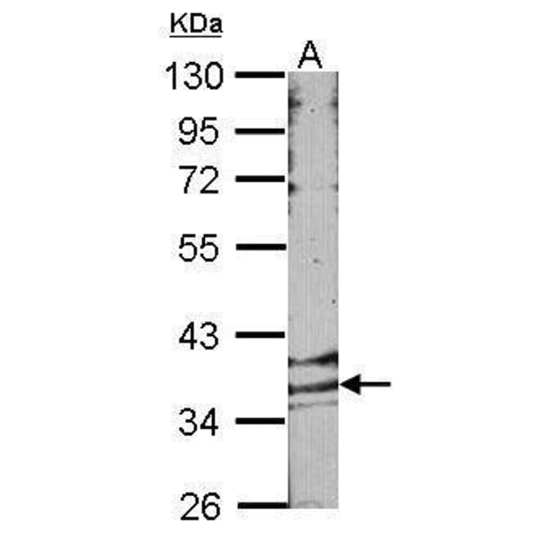GPR146 Antibody from Signalway Antibody (35332) - Antibodies.com