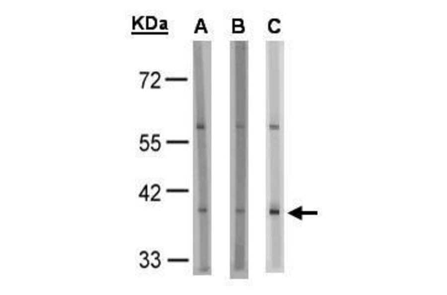 GPR91 Antibody from Signalway Antibody (35337) - Antibodies.com