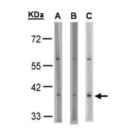GPR91 Antibody from Signalway Antibody (35337) - Antibodies.com