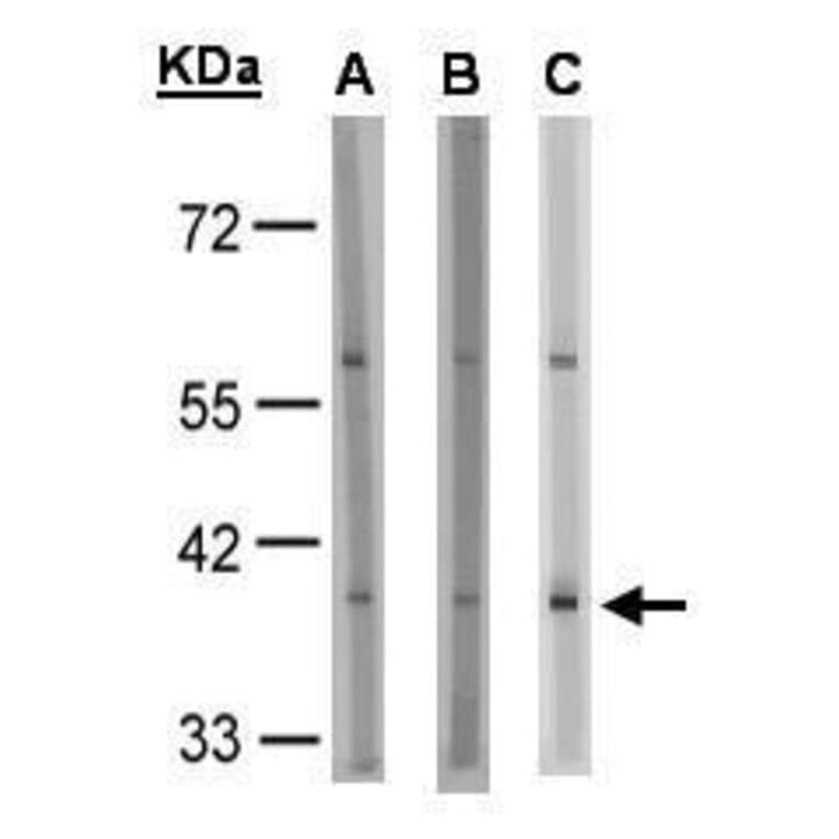 GPR91 Antibody from Signalway Antibody (35337) - Antibodies.com