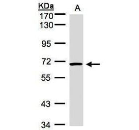 ACVRL1 Antibody from Signalway Antibody (35383) - Antibodies.com
