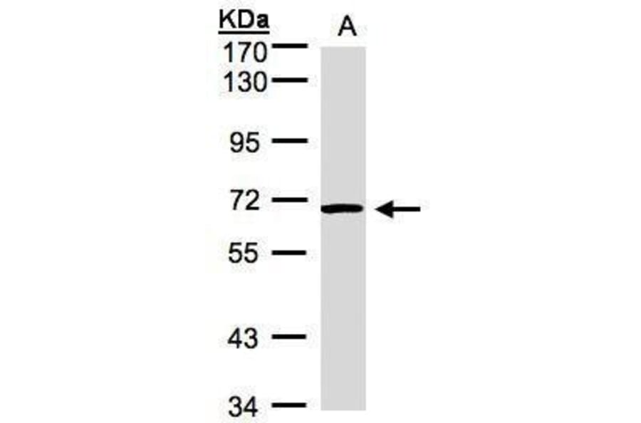 ACVRL1 Antibody from Signalway Antibody (35383) - Antibodies.com