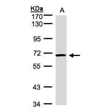 ACVRL1 Antibody from Signalway Antibody (35383) - Antibodies.com