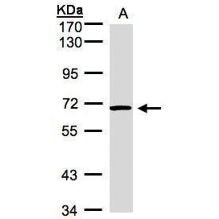 ACVRL1 Antibody from Signalway Antibody (35383) - Antibodies.com