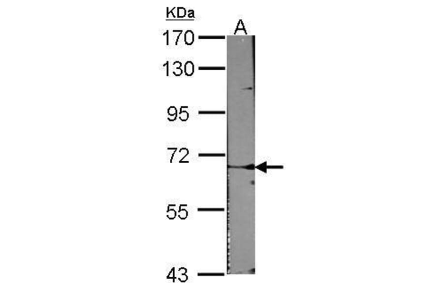ACVRL1 Antibody from Signalway Antibody (35383) - Antibodies.com