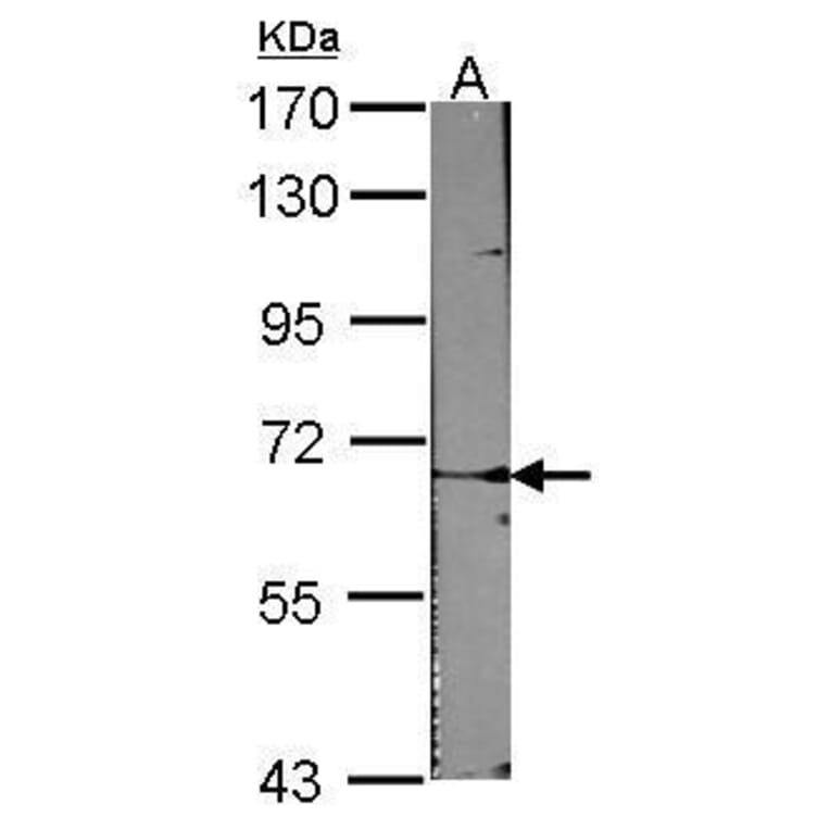 ACVRL1 Antibody from Signalway Antibody (35383) - Antibodies.com