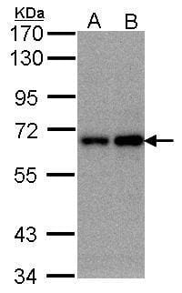 Sample (30 &#956;g of whole cell lysate)293TB: A431 C: H12997.5% SDS PAGE#35405 diluted at 1: 500