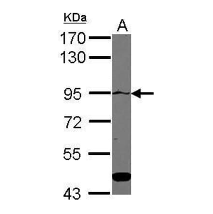 ATP2C1 Antibody from Signalway Antibody (35468) - Antibodies.com