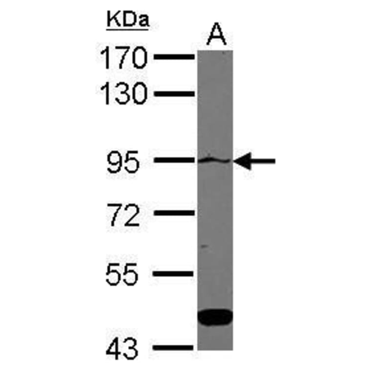 ATP2C1 Antibody from Signalway Antibody (35468) - Antibodies.com