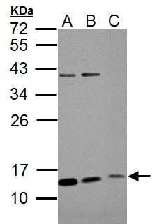 Sample (30 µg of whole cell lysate)  A549 B: H1299 C: MCF-7 12% SDS PAGE #35501 diluted at 1: 1000