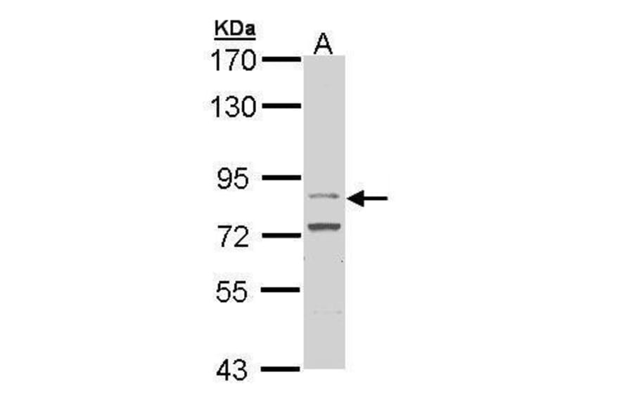 FGFR4 Antibody from Signalway Antibody (35516) - Antibodies.com