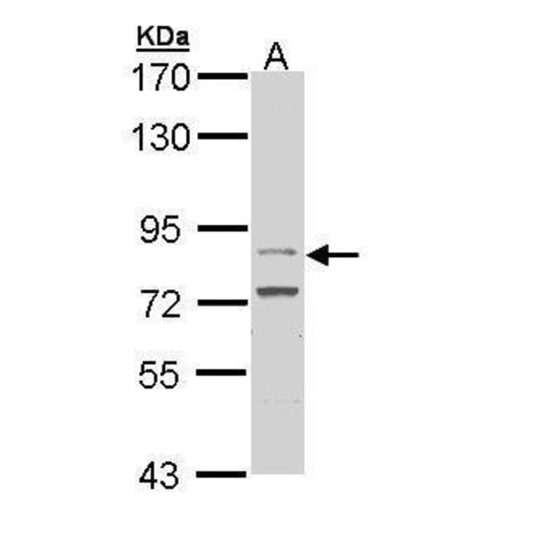FGFR4 Antibody from Signalway Antibody (35516) - Antibodies.com