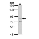 FGFR4 Antibody from Signalway Antibody (35516) - Antibodies.com