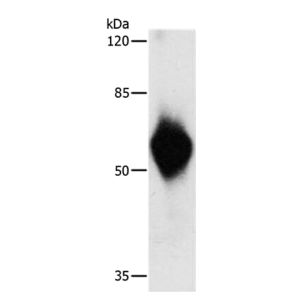 HA Tag Antibody from Signalway Antibody (35534) - Antibodies.com