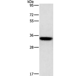 HOXB13 Antibody from Signalway Antibody (35768) - Antibodies.com