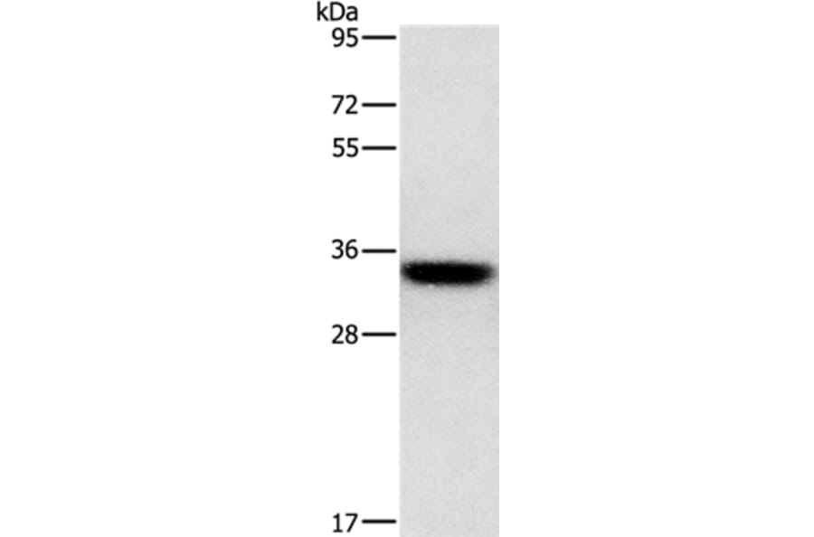 HOXB13 Antibody from Signalway Antibody (35768) - Antibodies.com
