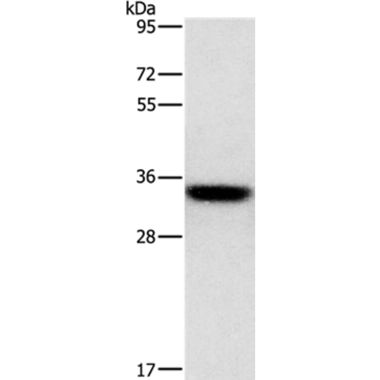 HOXB13 Antibody from Signalway Antibody (35768) - Antibodies.com