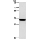 HOXB13 Antibody from Signalway Antibody (35768) - Antibodies.com