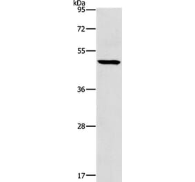 HOXC10 Antibody from Signalway Antibody (35769) - Antibodies.com