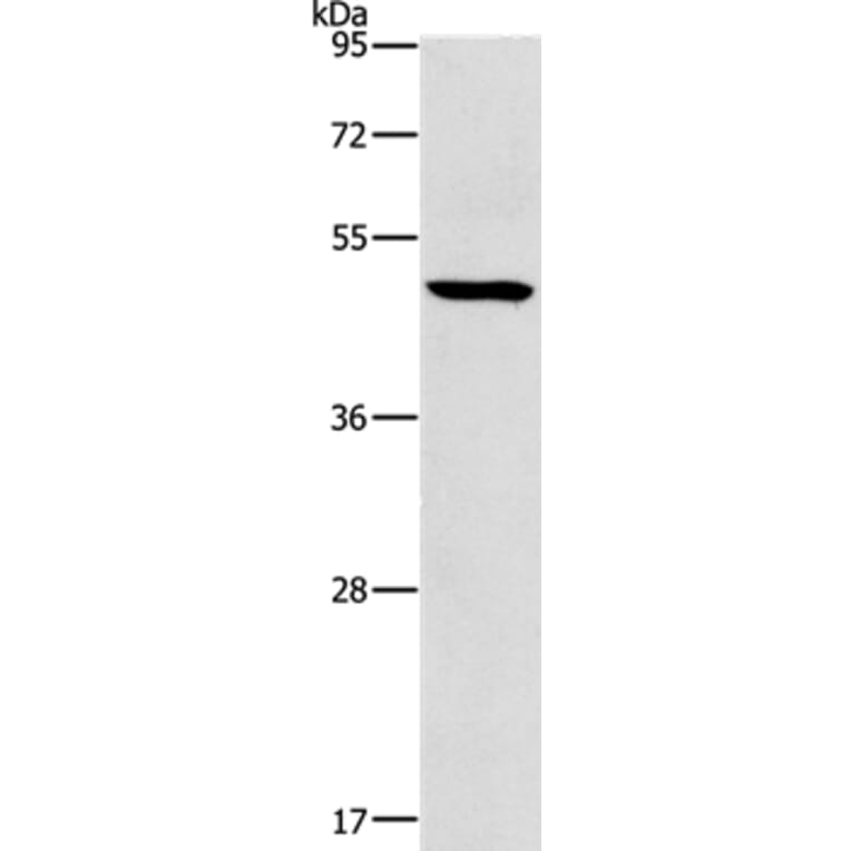 HOXC10 Antibody from Signalway Antibody (35769) - Antibodies.com