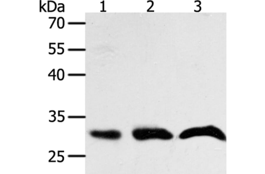 PTGES2 Antibody from Signalway Antibody (35898) - Antibodies.com