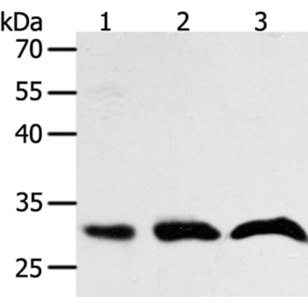 PTGES2 Antibody from Signalway Antibody (35898) - Antibodies.com