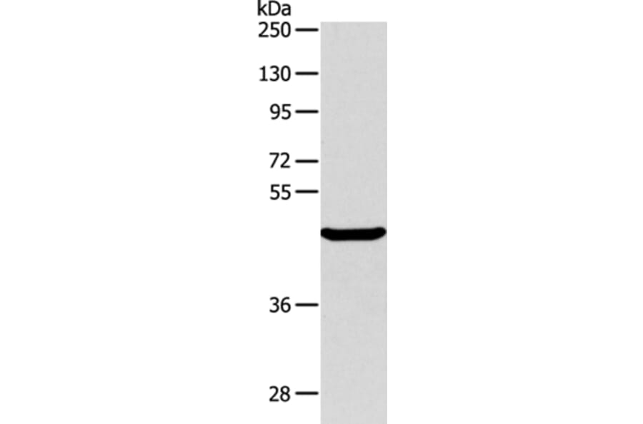 ALKBH1 Antibody from Signalway Antibody (36007) - Antibodies.com