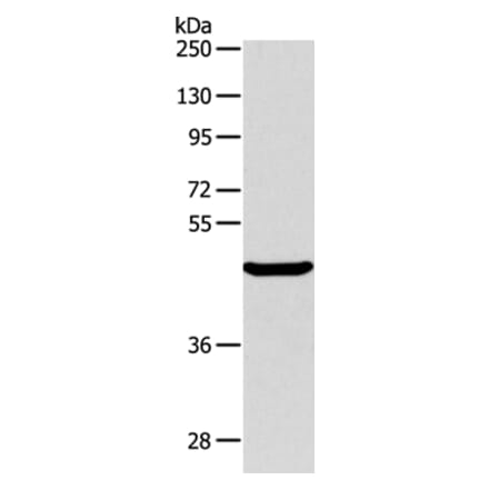 ALKBH1 Antibody from Signalway Antibody (36007) - Antibodies.com