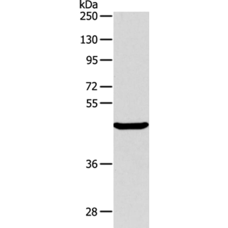 ALKBH1 Antibody from Signalway Antibody (36007) - Antibodies.com