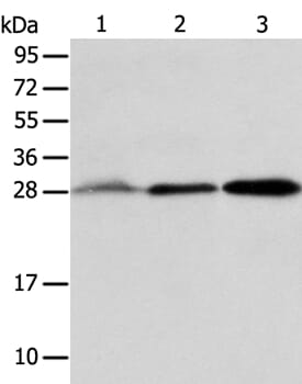 Gel: 12% SDS-PAGE Lysates (from left to right): Human fetal liver and seminoma tissue, RAW264.7 cell Amount of lysate: 40ug per lane Primary antibody: 1/800 dilution Secondary antibody dilution: 1/8000 Exposure time: 2 minutes