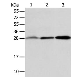 ALKBH2 Antibody from Signalway Antibody (36008) - Antibodies.com