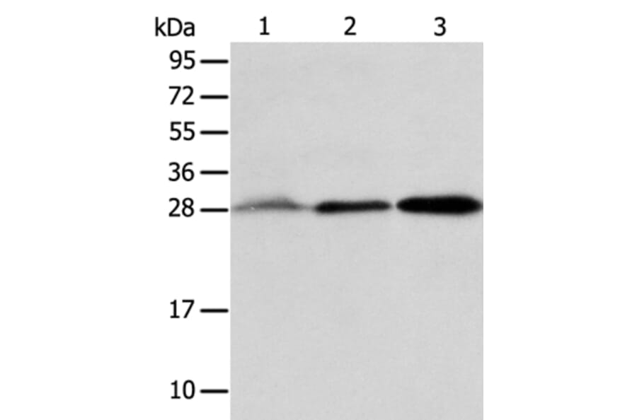 ALKBH2 Antibody from Signalway Antibody (36008) - Antibodies.com