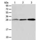 ALKBH2 Antibody from Signalway Antibody (36008) - Antibodies.com