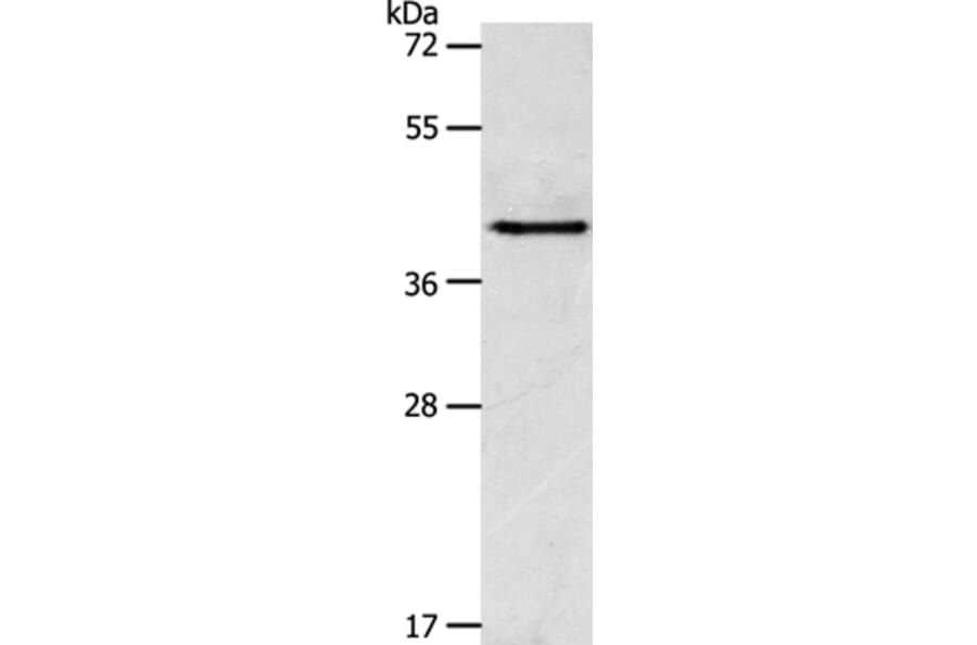 ACTR1A Antibody from Signalway Antibody (36031) - Antibodies.com