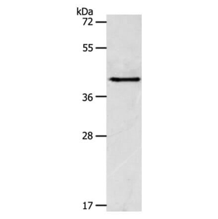 ACTR1A Antibody from Signalway Antibody (36031) - Antibodies.com