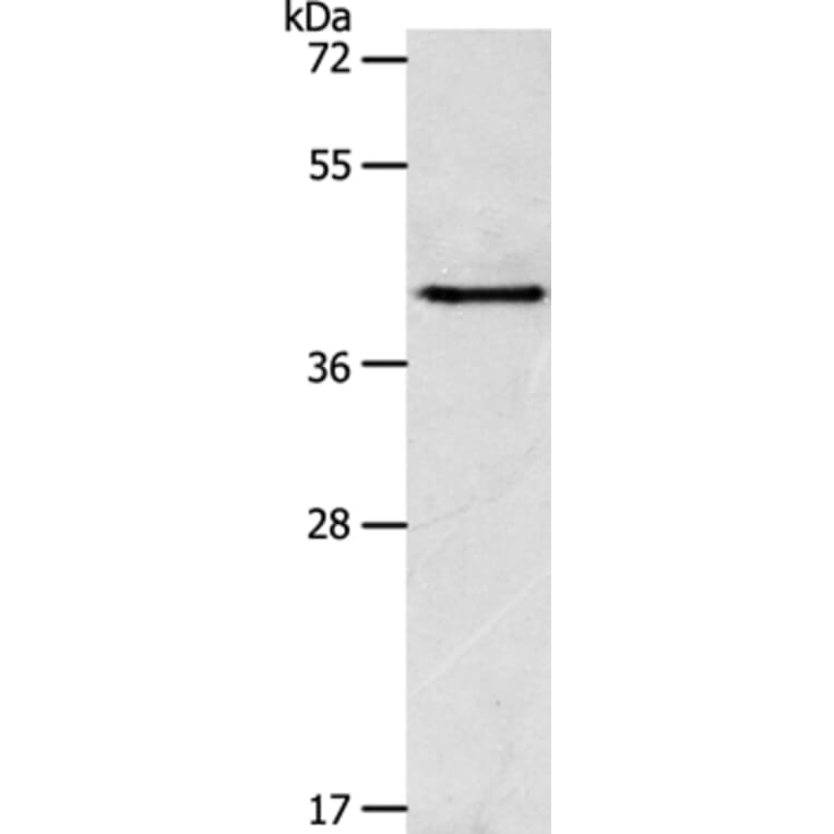 ACTR1A Antibody from Signalway Antibody (36031) - Antibodies.com