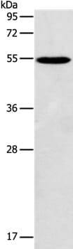 Gel: 10% SDS-PAGE Lysates (from left to right): Mouse testis tissue Amount of lysate: 40ug per lane Primary antibody: 1/117 dilution Secondary antibody dilution: 1/8000 Exposure time: 5 seconds