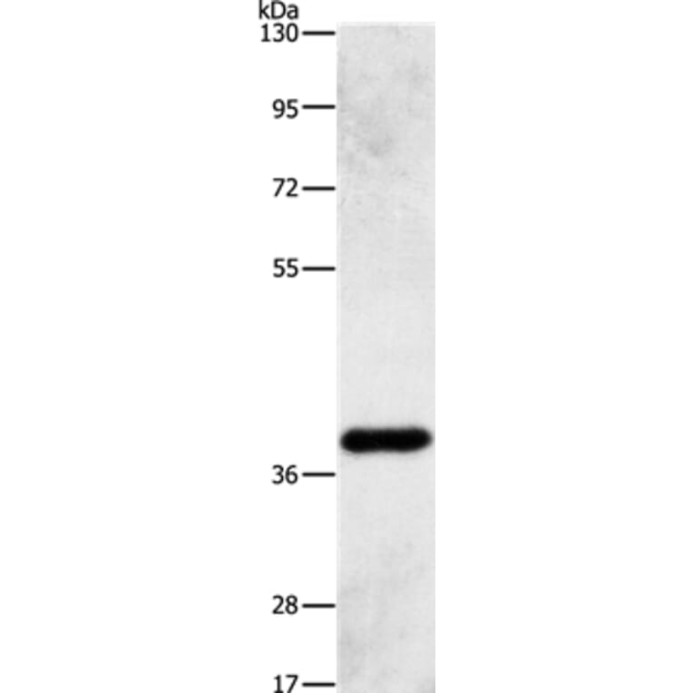 PRKAG1 Antibody from Signalway Antibody (36098) - Antibodies.com