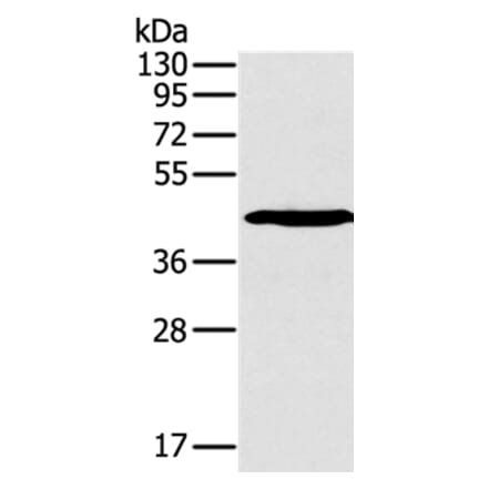 SLAMF1 Antibody from Signalway Antibody (36320) - Antibodies.com