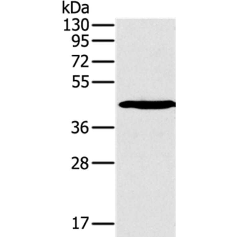 SLAMF1 Antibody from Signalway Antibody (36320) - Antibodies.com