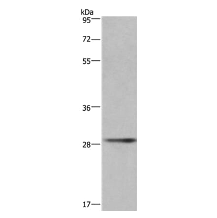 CD40LG Antibody from Signalway Antibody (36331) - Antibodies.com