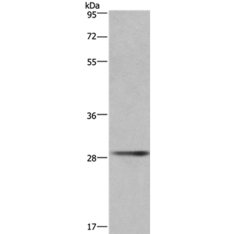 CD40LG Antibody from Signalway Antibody (36331) - Antibodies.com
