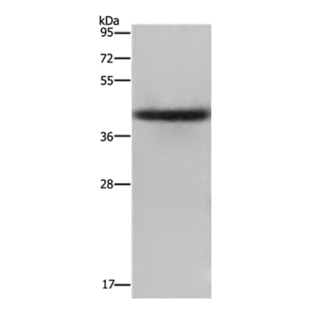 EPSTI1 Antibody from Signalway Antibody (36445) - Antibodies.com