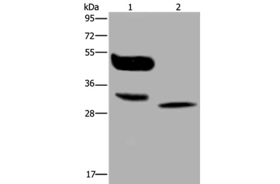 MAGEA8 Antibody from Signalway Antibody (36595) - Antibodies.com