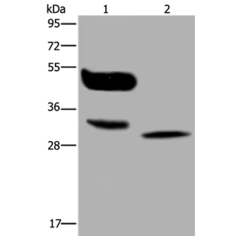 MAGEA8 Antibody from Signalway Antibody (36595) - Antibodies.com